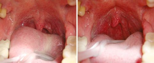 Dental Excellence Integrative Center | Biomimetic Dentistry, Dental Implants and Oral Cancer Screening
