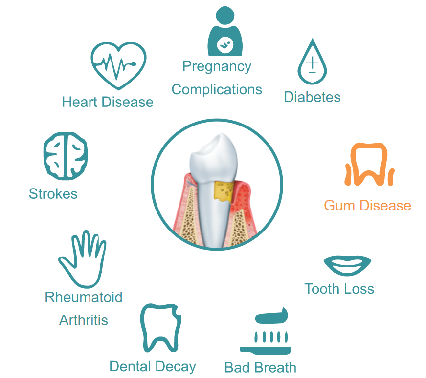 Dental Excellence Integrative Center | Laser Cavity Finder, Periodontal Therapy and TMJ Therapy