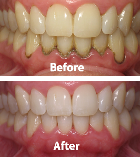 Dental Excellence Integrative Center | Alternatives to Orthodontics, Green CT and Cosmetic Dentistry