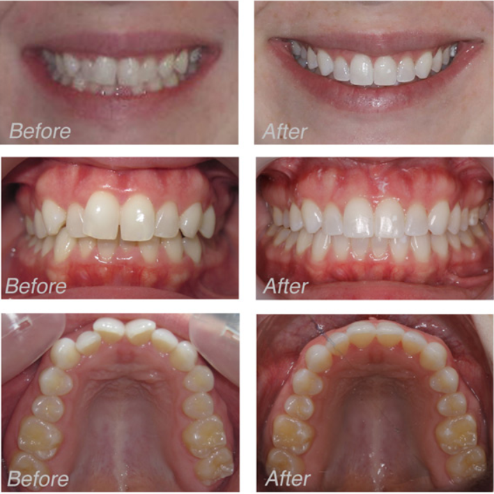 Dental Excellence Integrative Center | Sleep Apnea Appliances, Biomimetic Dentistry and Laser Cavity Fix