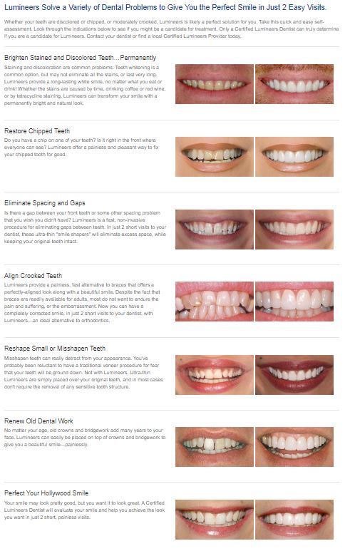 Dental Excellence Integrative Center | Mercury Free, Toothaches and Recession Treatment