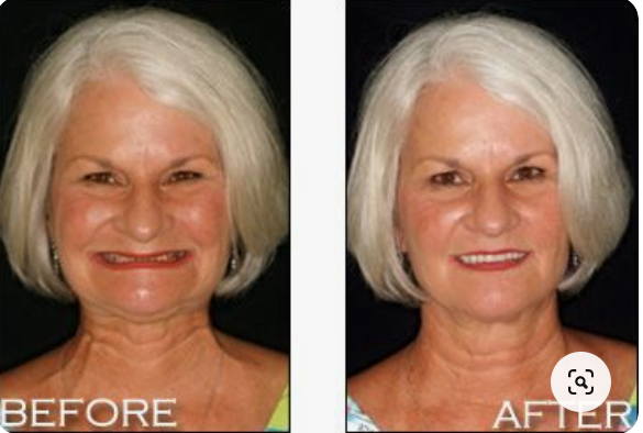 Dental Excellence Integrative Center | Laser Dentistry, Sedation Dentistry and Periodontal Therapy