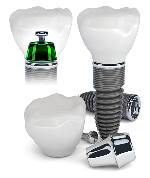 Dental Excellence Integrative Center | Recession Treatment, Cosmetic and Alternatives to Orthodontics