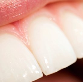 Dental Excellence Integrative Center | Take Home Sleep Study, Oral Cancer Screening and Nu Calm reg 