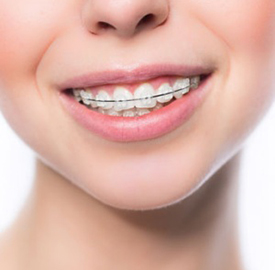 Dental Excellence Integrative Center | Cold Sores  amp  Canker Sores, Orthodontics and Dental Implants