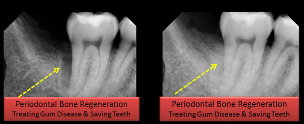 Dental Excellence Integrative Center | Take Home Sleep Study, Sedation Dentistry and Early Orthodontics