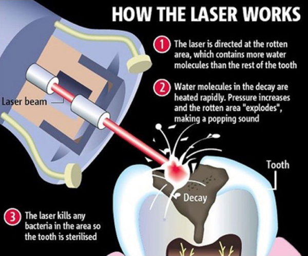 Dental Excellence Integrative Center | Sedation Dentistry, Airway Improvement and Cosmetic Dentistry